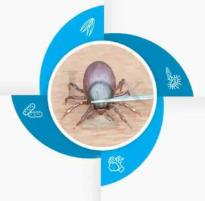 IGeneX Lyme Disease Treatment